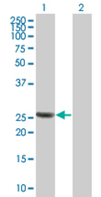 Lane 1: ANXA3 transfected lysate (35.64 KDa) Lane 2: Non-transfected lysate.