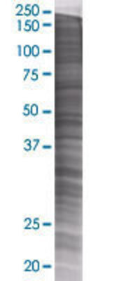 EXOD1 transfected lysate.
