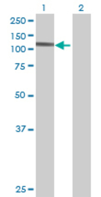 Lane 1: BRD2 transfected lysate (88.22 KDa) Lane 2: Non-transfected lysate.