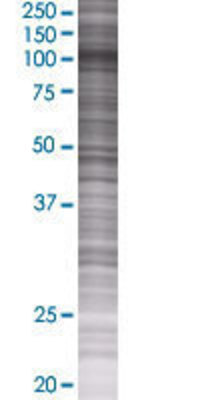 BRD2 transfected lysate.