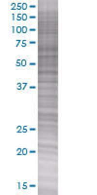 DOK1 transfected lysate