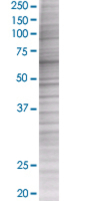 ZNF18 transfected lysate.