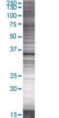 TLX3 transfected lysate.
