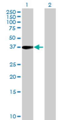 Lane 1: TLX3 transfected lysate (32.12 KDa) Lane 2: Non-transfected lysate.