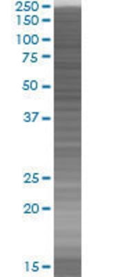LRP1 transfected lysate.