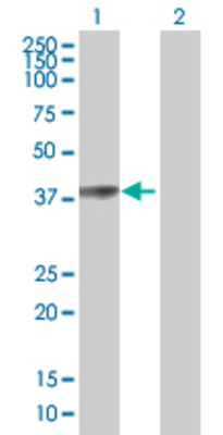 Lane 1: PARK2 transfected lysate (42.4 KDa) Lane 2: Non-transfected lysate.