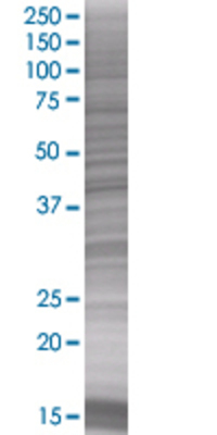 WDR51A transfected lysate.