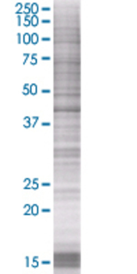 SERPINA5 transfected lysate.