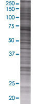 PIAS2 transfected lysate.