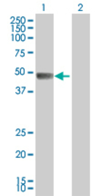Lane 1: PAH transfected lysate (51.8 KDa) Lane 2: Non-transfected lysate.