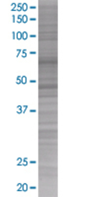 SERPINH1 transfected lysate