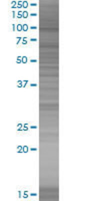 ATP2C1 transfected lysate.