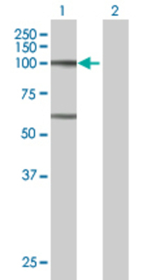 Lane 1: ATP2C1 transfected lysate (100.6 KDa) Lane 2: Non-transfected lysate.