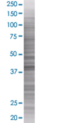 CENTA1 transfected lysate.