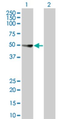 Lane 1: GC transfected lysate (52.9 KDa) Lane 2: Non-transfected lysate.