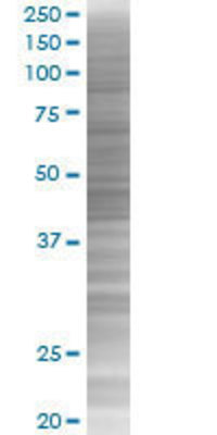 MLX transfected lysate.