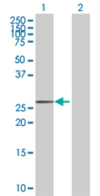 Lane 1: MLX transfected lysate (23.65 KDa) Lane 2: Non-transfected lysate.