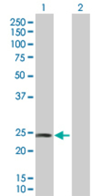 Lane 1: DIRAS2 transfected lysate (22.5 KDa). Lane 2: Non-transfected lysate.