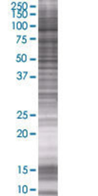 CENTB2 transfected lysate.