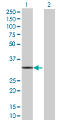 Lane 1: ANXA5 transfected lysate (35.31 KDa) Lane 2: Non-transfected lysate.