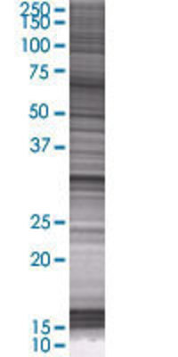 ANXA5 transfected lysate.