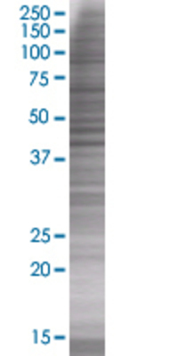 BXDC2 transfected lysate