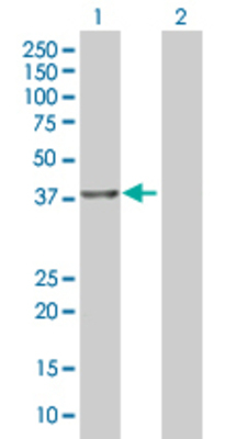 Lane 1: BXDC2 transfected lysate (38.94 KDa). Lane 2: Non-transfected lysate.