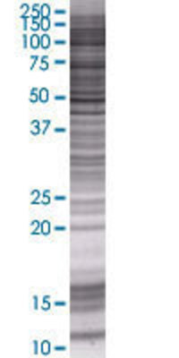 RPP21 transfected lysate.