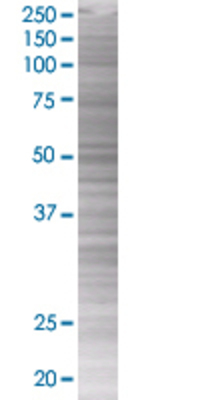 IL1R1 transfected lysate.