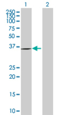 Lane 1: IL1R1 transfected lysate (65.4 KDa) Lane 2: Non-transfected lysate.