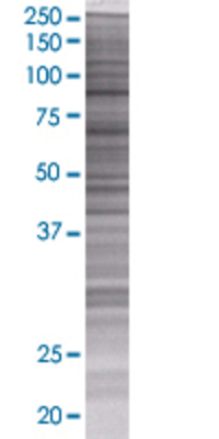 FBXO11 transfected lysate.