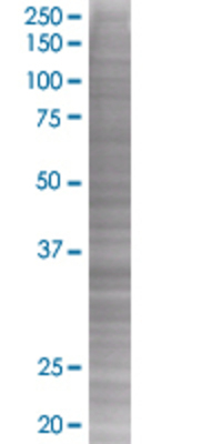 MAD2L1BP transfected lysate