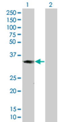 Lane 1: MAD2L1BP transfected lysate (30.25 KDa). Lane 2: Non-transfected lysate.