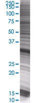IFI35 transfected lysate.