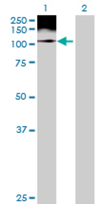 Lane 1: EMR1 transfected lysate (90.42 KDa) Lane 2: Non-transfected lysate.