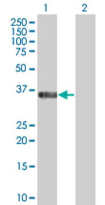 Lane 1: CPNE5 transfected lysate (33.22 KDa) Lane 2: Non-transfected lysate.