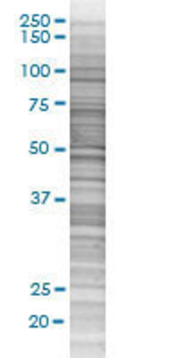 CPNE5 transfected lysate.