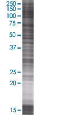 PARG transfected lysate.
