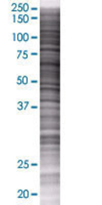 CARS transfected lysate.