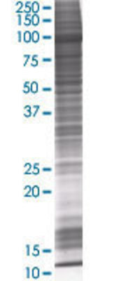 HOOK1 transfected lysate.