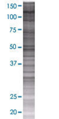 IARS transfected lysate.