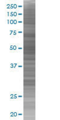 CYP11A1 transfected lysate.