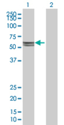 Lane 1: CYP11A1 transfected lysate (60.1 KDa) Lane 2: Non-transfected lysate.