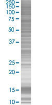 PSMD2 transfected lysate.
