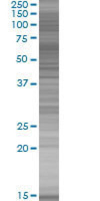 KIAA1443 transfected lysate.