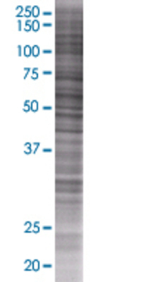 PRUNE transfected lysate.