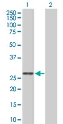 Lane 1: HLA-DMA transfected lysate (29.2 KDa). Lane 2: Non-transfected lysate.