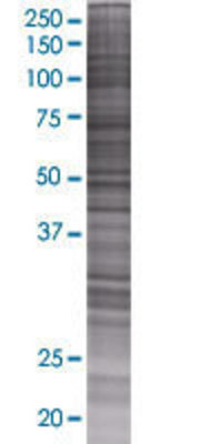 DHRSX transfected lysate.