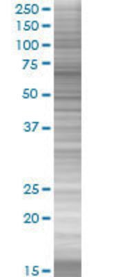 PGM3 transfected lysate.