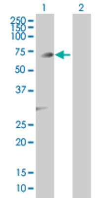 Lane 1: PGM3 transfected lysate (59.9 KDa) Lane 2: Non-transfected lysate.